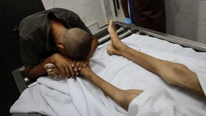 Gazze'de Yaşanan Açlık Krizi: Bir Çocuk Daha Hayatını Kaybetti